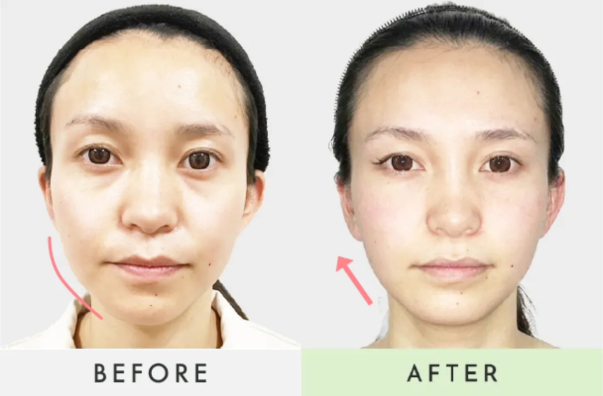 ビフォーアフター画像