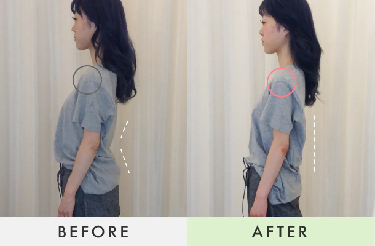Before-After