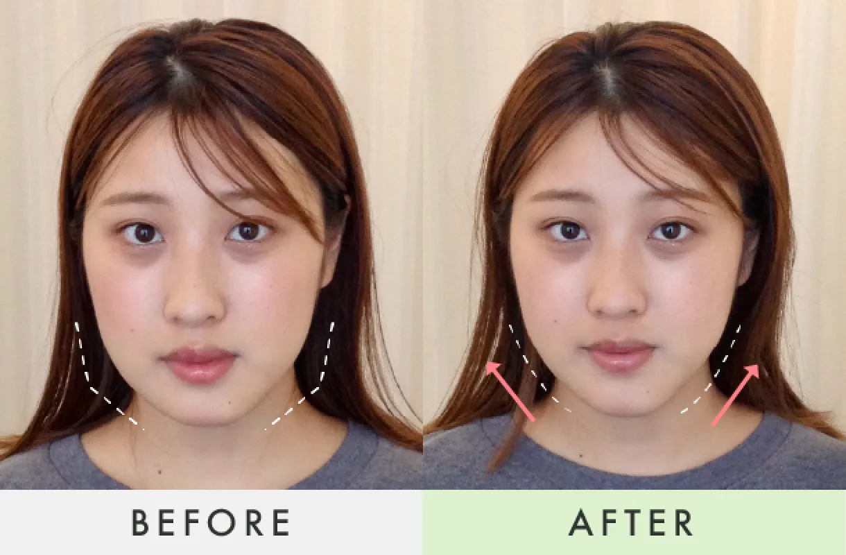 Before-After